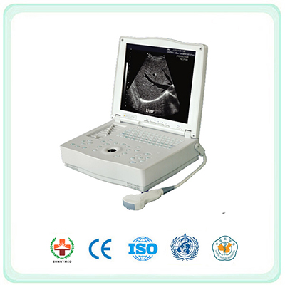 S-3000E1 Laptop Ultrasound Machine